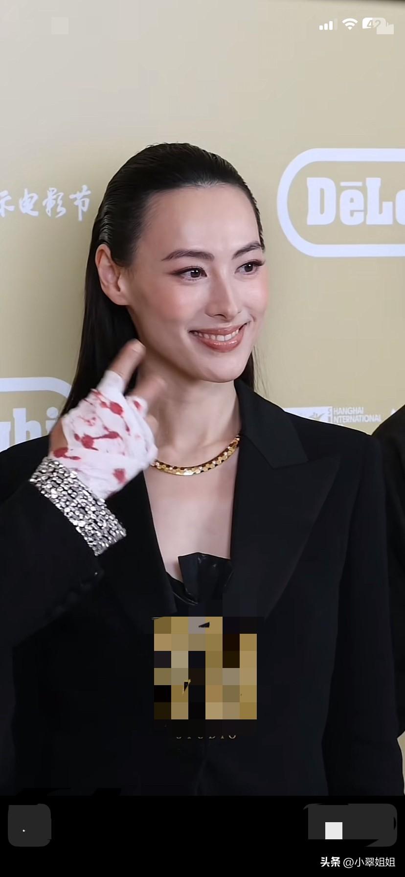 梁洛施很美，五官无可挑剔！甚至是完美！唯一不足的就是脸太长了！脑门太宽！有点秃头