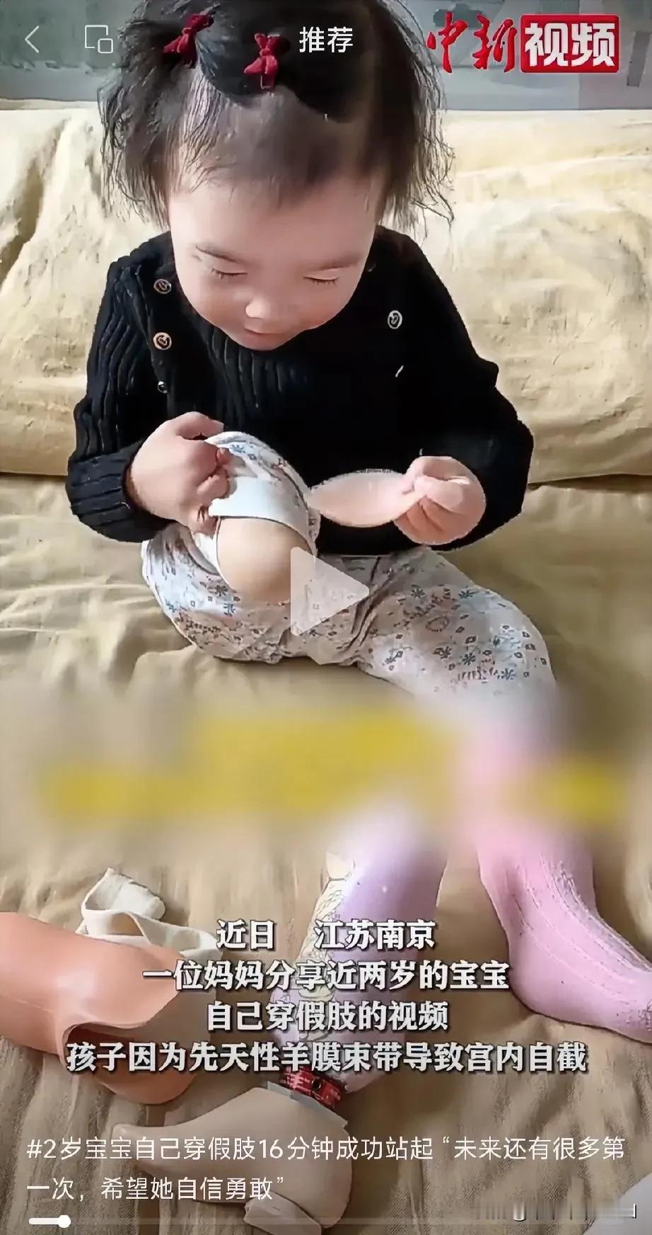 让人泪目又勇敢的宝贝儿，加油↖(^ω^)↗[加油][加油][加油]#我来唠家常#