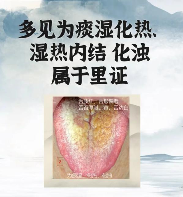 舌象里藏着大问题，6 种常见体质对照看