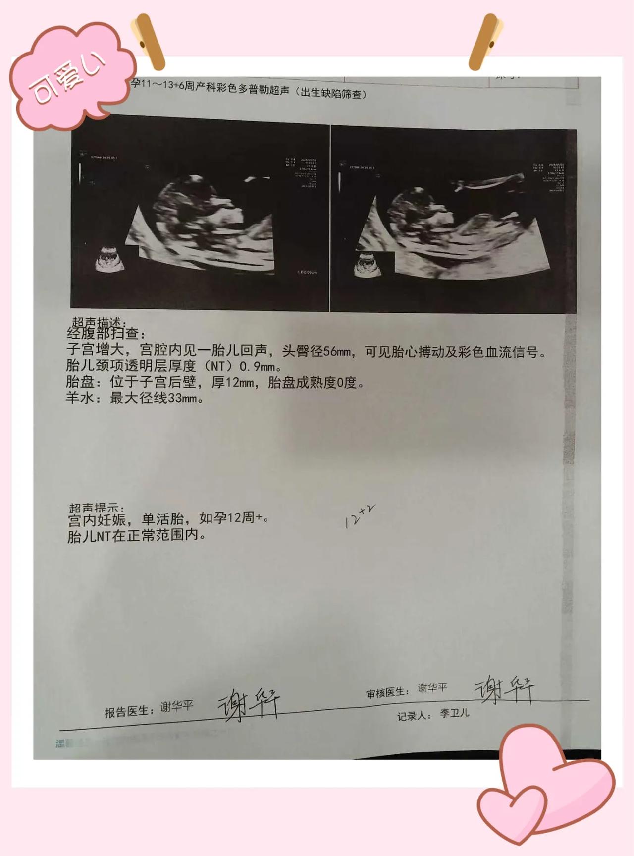 🌸木棉花开 天使到来🌸
✨刘颖主任好孕分享来啦！✨
      历经两次胎停