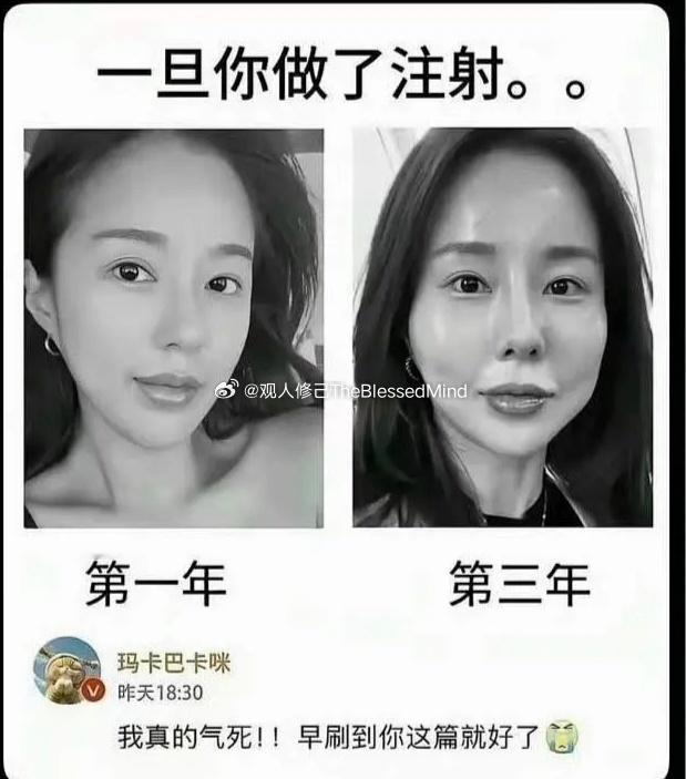 医美过度了的脸[泪奔] ​​​