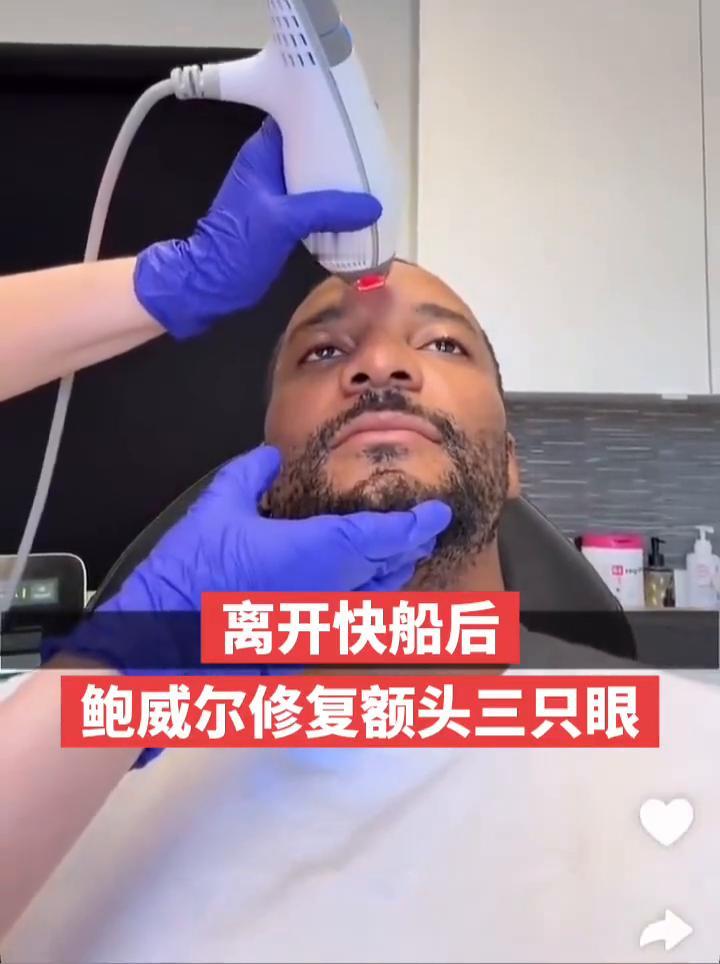 离开快船后鲍威尔修复额头三只眼。
