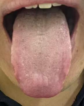 滋阴填精法调治肝肾阴虚男科诸证指南








不少粉丝留言咨询：房事把控不