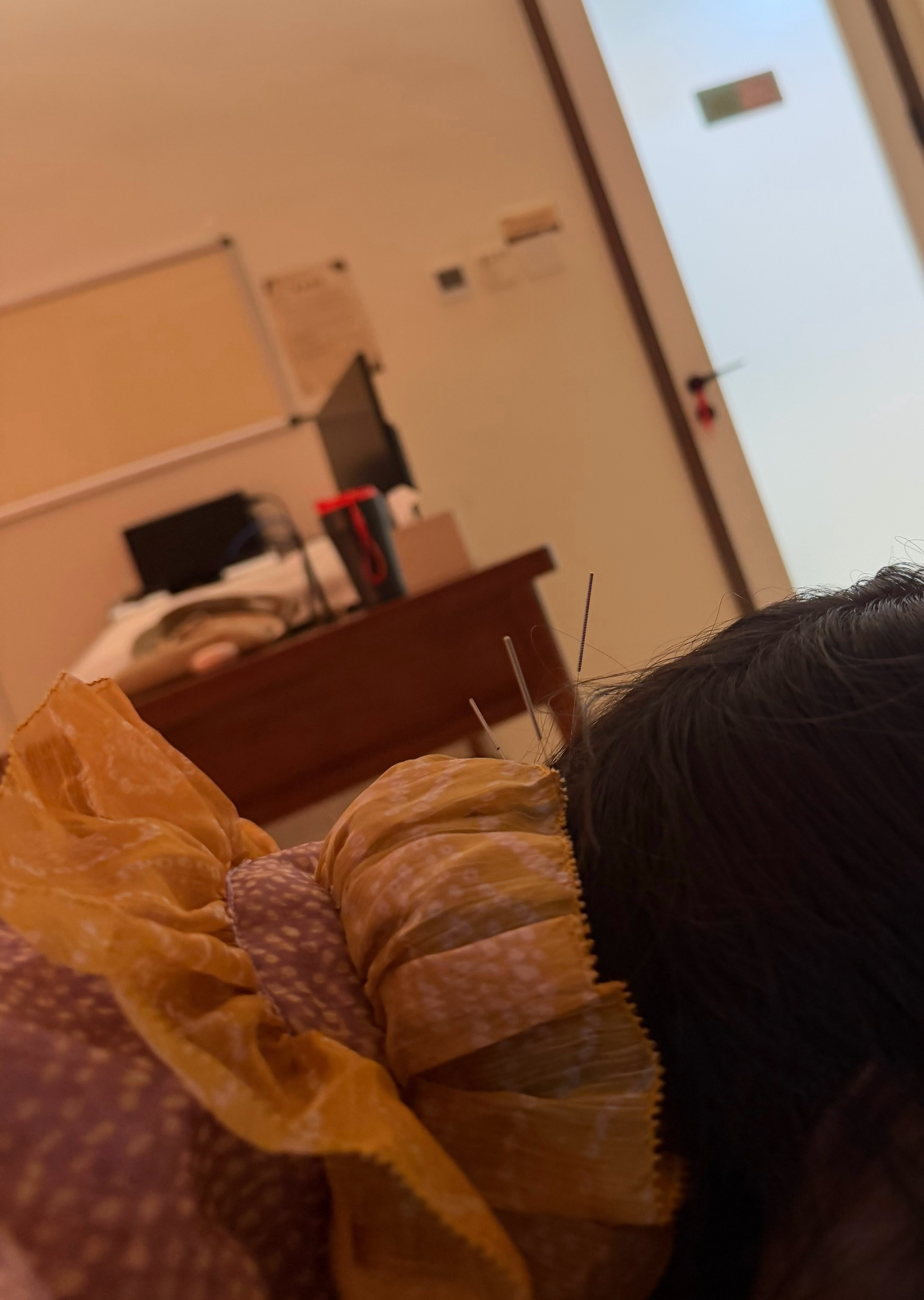 按时报道 今天去针灸啦～每个人都有自己的缓解方式大家 ：去健身 去按摩 去唱歌?