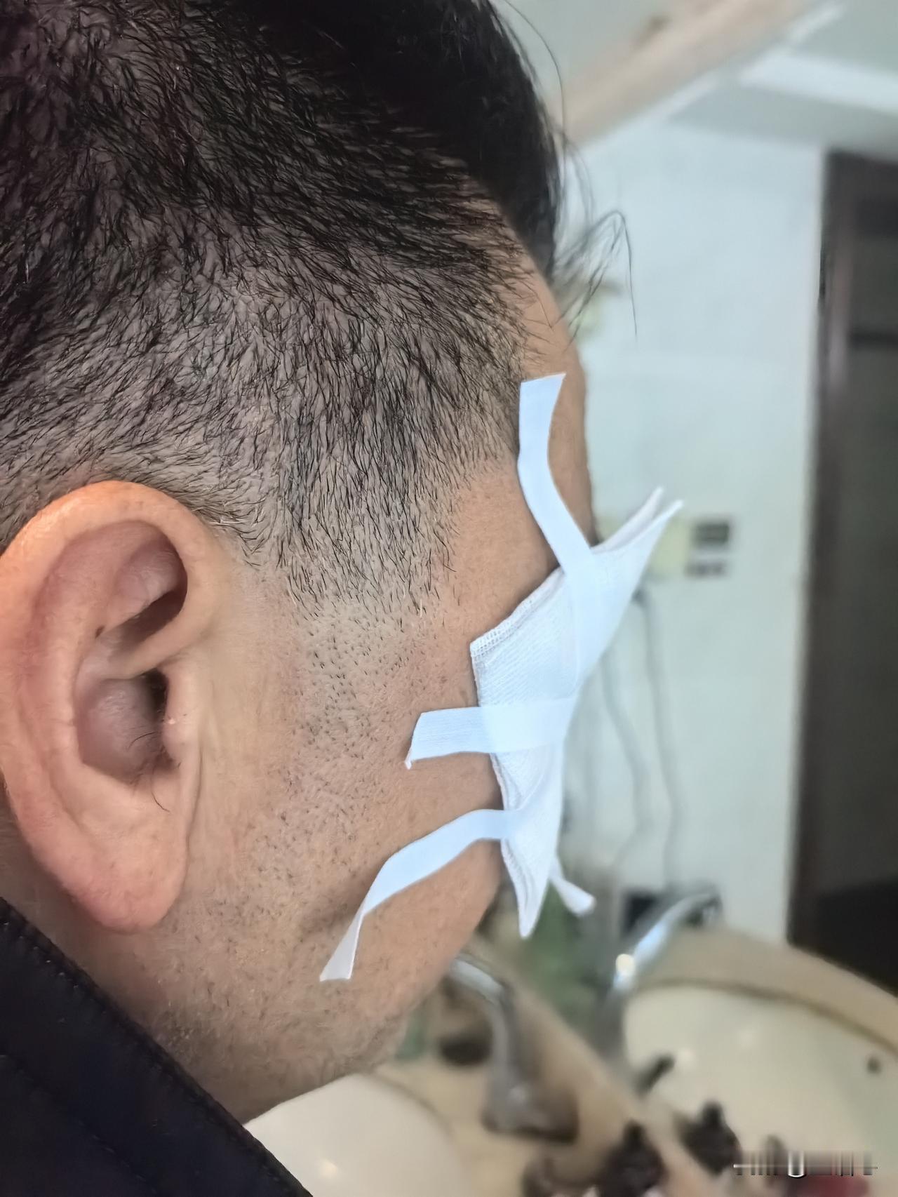 [流泪]血腥的一幕发生了，老公打羽毛球被搭档的拍子击中了眼晴，鲜血直流，目前视物