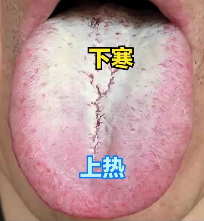 上热下寒——黄连汤，上下都寒——真武汤，上下都热——黄连阿胶

1、上热下寒——