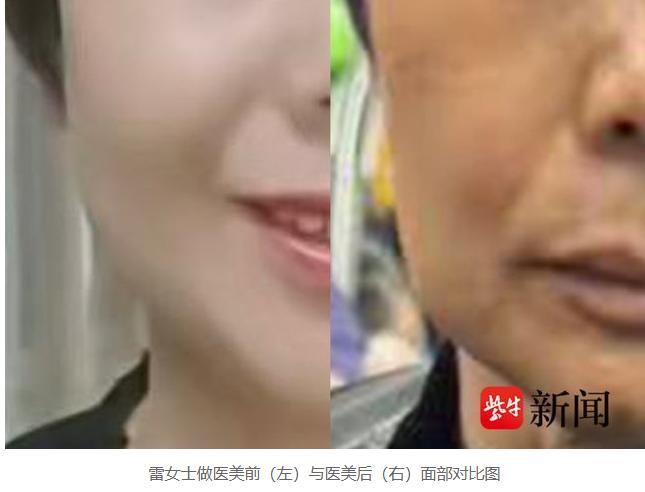 “年轻10岁”的梦，花光了她一辈子的积蓄。雷女士在微商的嘘寒问暖中放下防备，从买