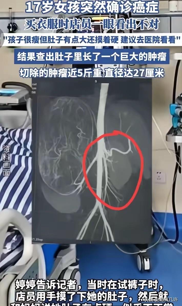 2025年6月，广东17岁女孩和妈妈一起逛街买衣服，在试裤子的时候，老板娘发觉女