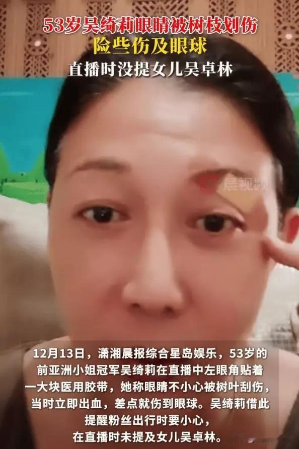 12月13日，53岁的前亚洲小姐冠军吴绮莉在直播时左眼角贴着大块医用胶带。她透露