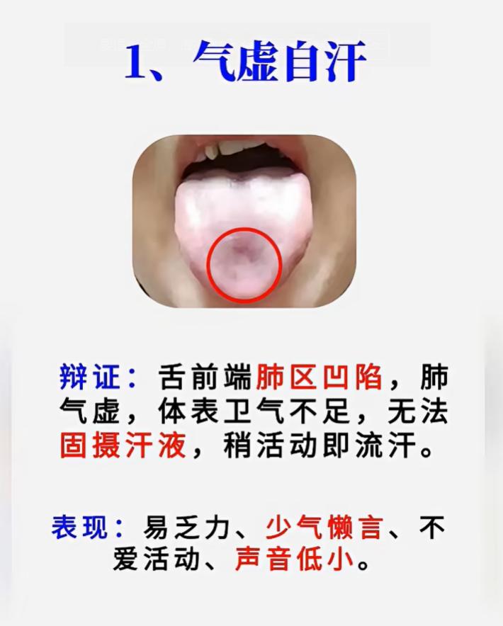 不同地方出汗代表什么？5 组舌象，看懂出汗背后问题