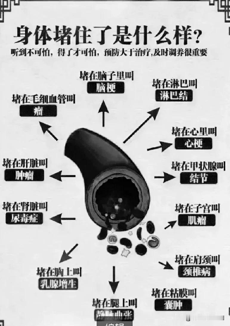 身体堵住了是什么样？听到不可怕，得了才可怕，预防大于治疗，及时调养很重要

在日
