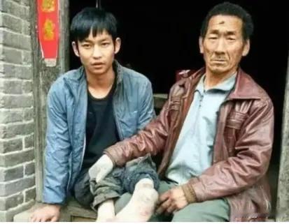 1991年，河南一对夫妻生下残疾儿子不想养，便将儿子扔在草丛里，谁料，村里一个大