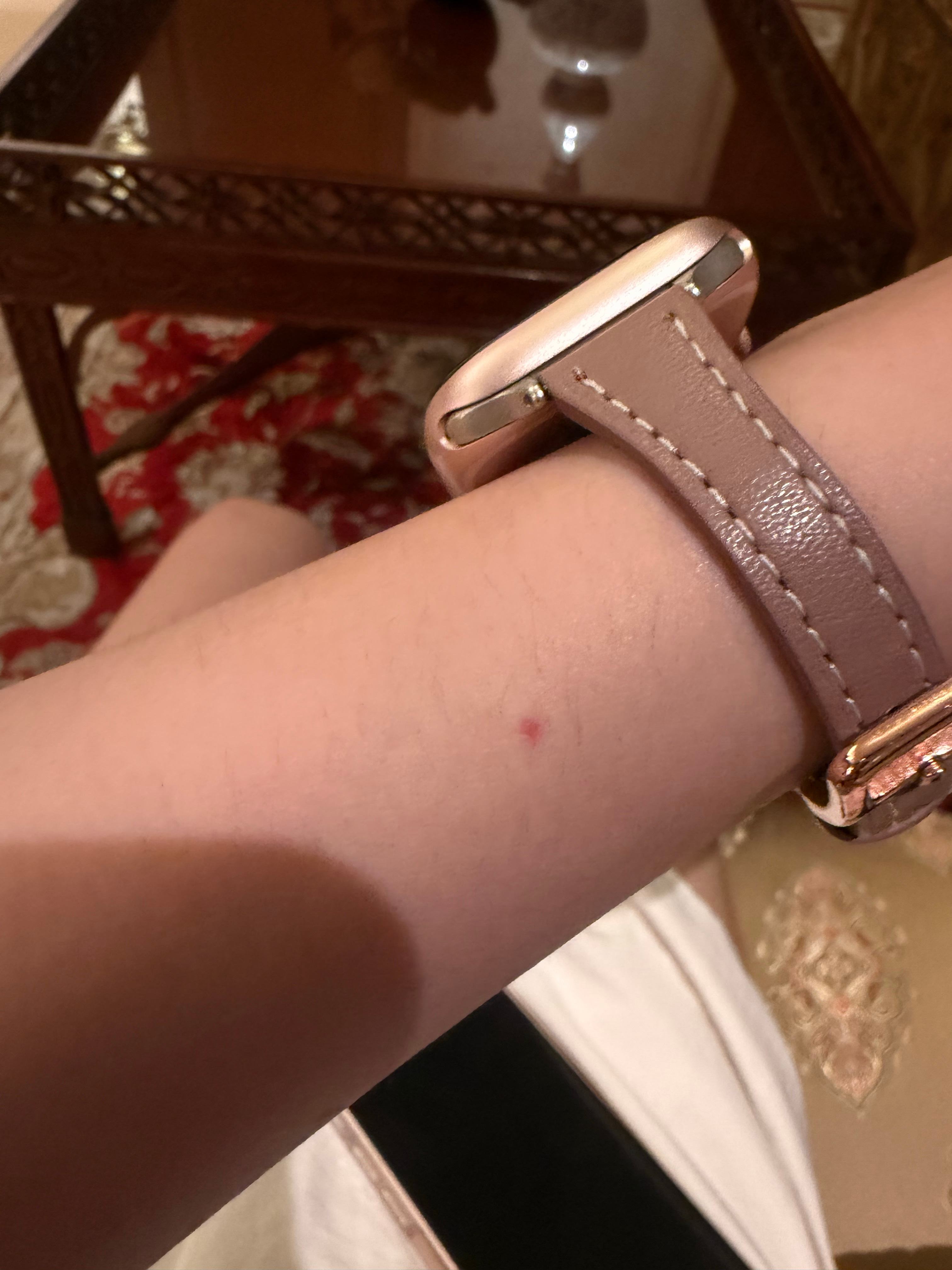 老娘真的带假货会过敏 买了一个爱马仕的假表带直接过敏 几年前买了一个假项链也是过