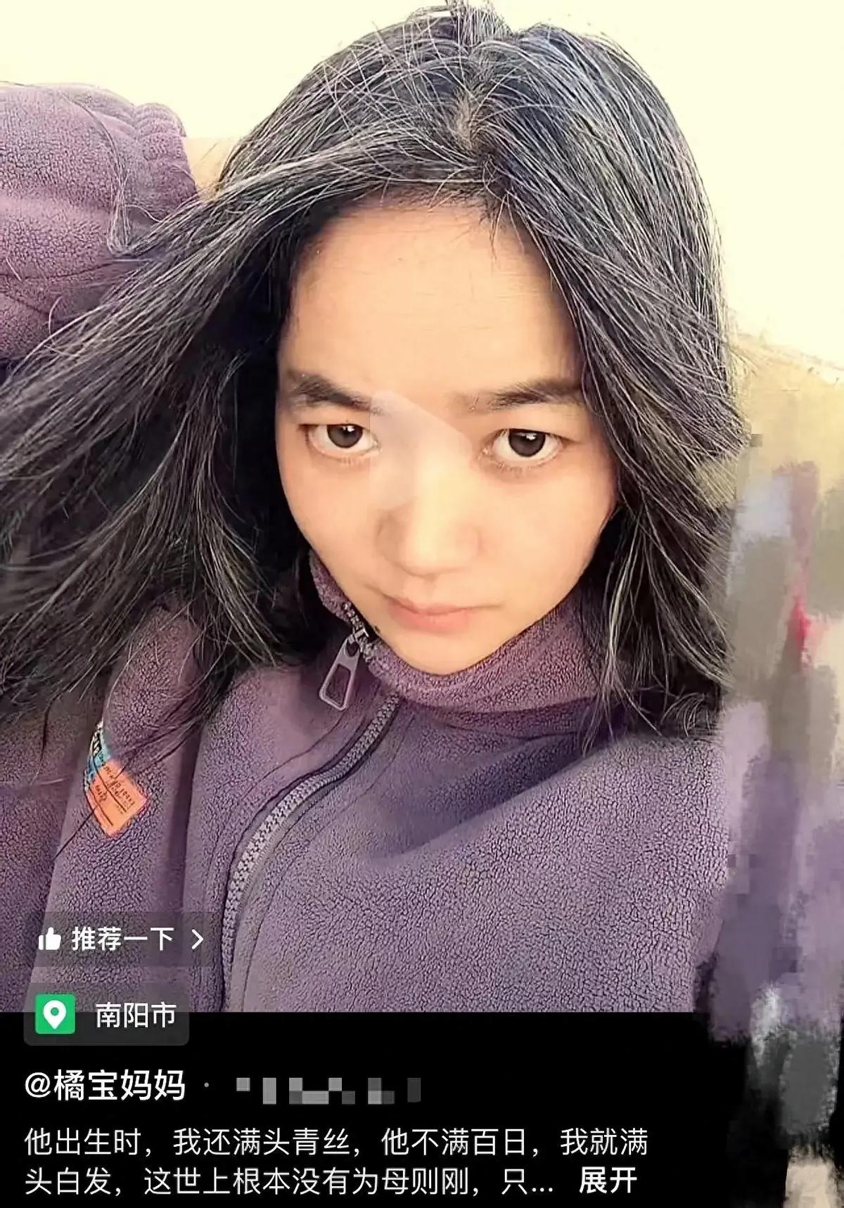 看哭了！3 岁儿子因罕见病去世，33 岁妈妈一头青丝变白发！她每隔 10 天就去