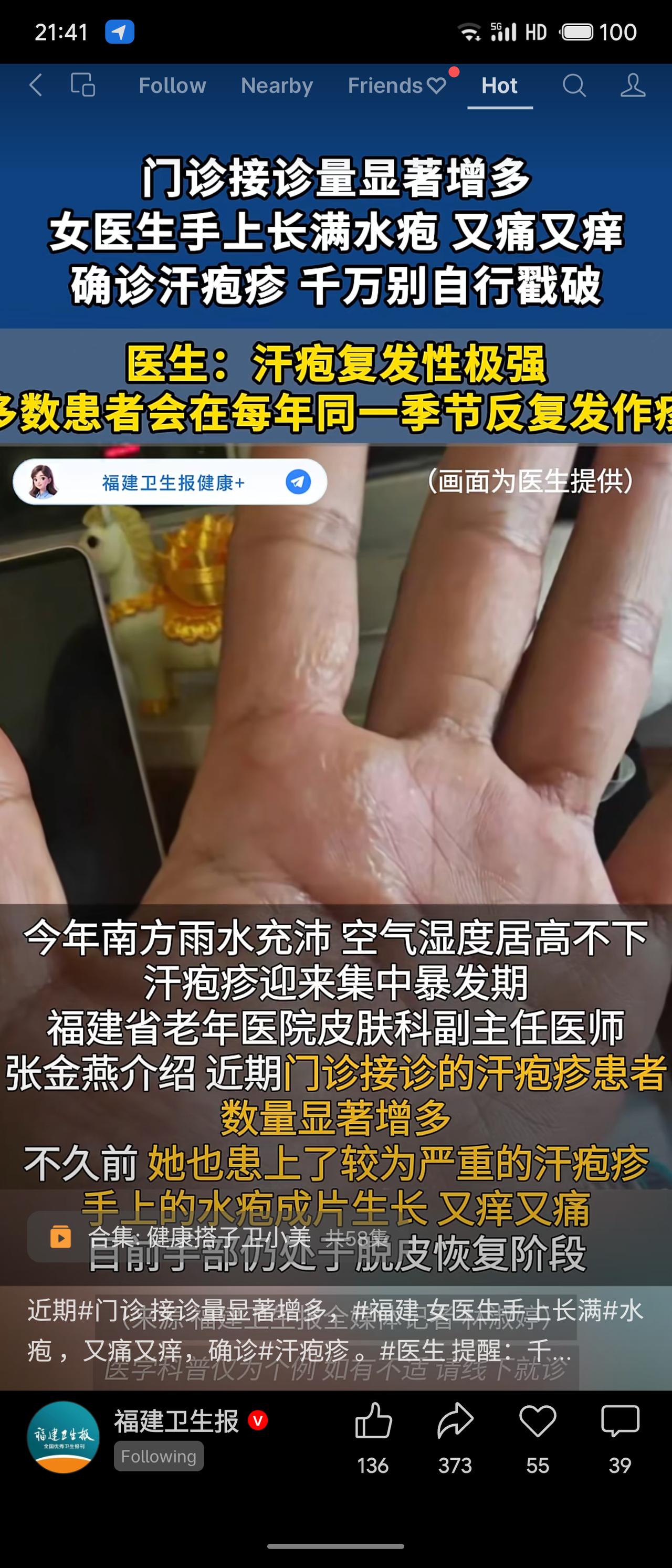 近期南方雨水充沛，汗疱疹进入集中暴发期，门诊接诊量显著增多。福建省老年医院一位女
