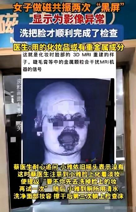太诡异了
做头颅磁共振两次失败
元凶居然是

脸上的护肤品和彩妆！福建这位29岁