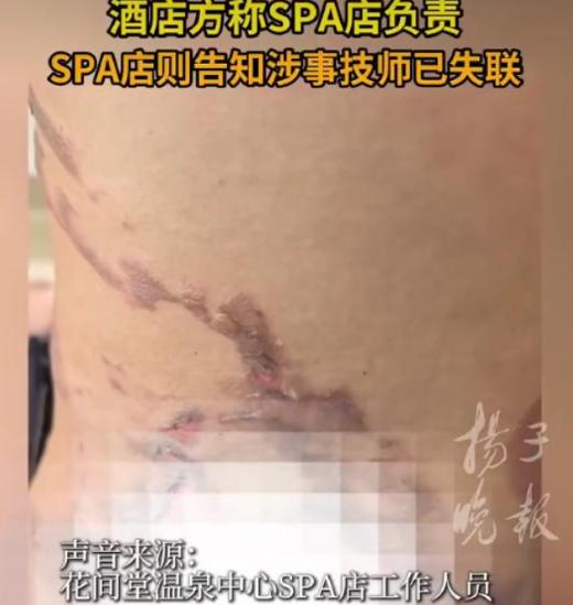 湖北武汉，女生跟朋友去酒店里开房，办理好入住后，女子准备去酒店的养生馆做个spa