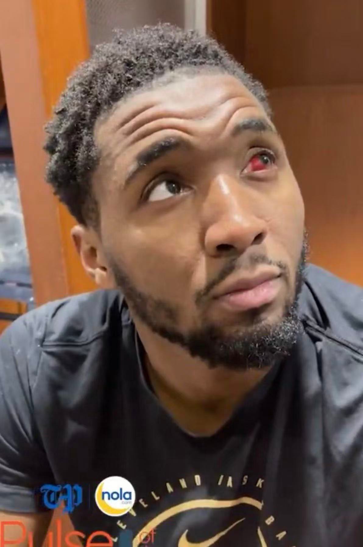 “血轮眼” 组合 