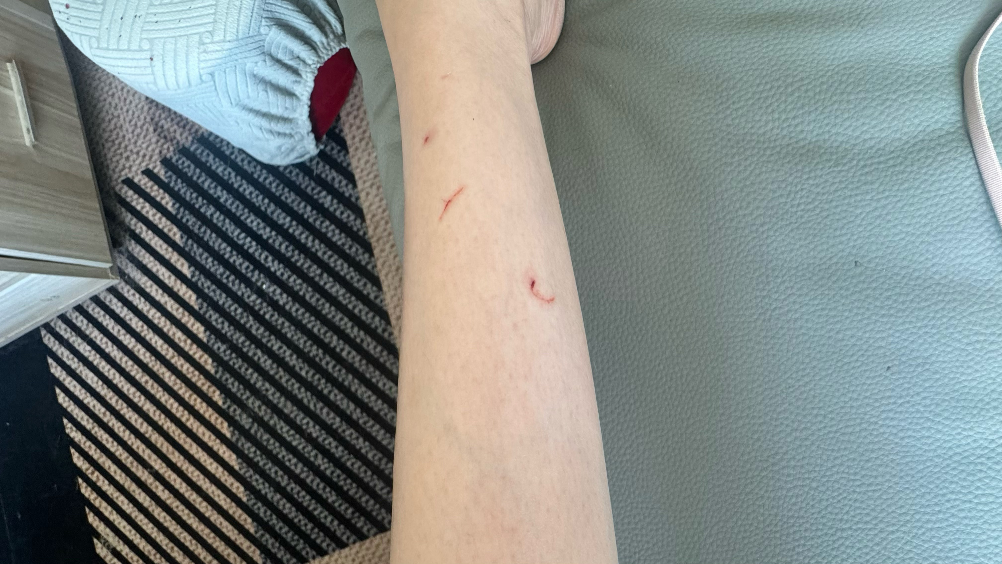 这Joy天天追着虎妞打架🫯次次受伤的总是我🤕 
