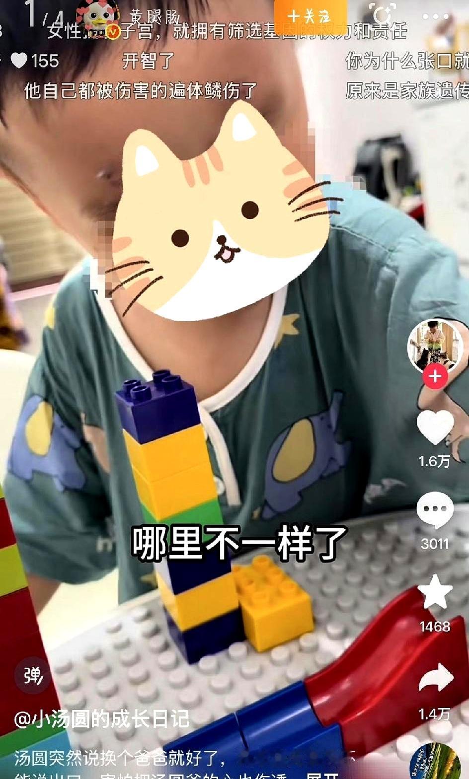 连看三遍那个热搜视频，我没忍住红了眼眶：明知道生下来的孩子注定要被嘲笑一辈子，父