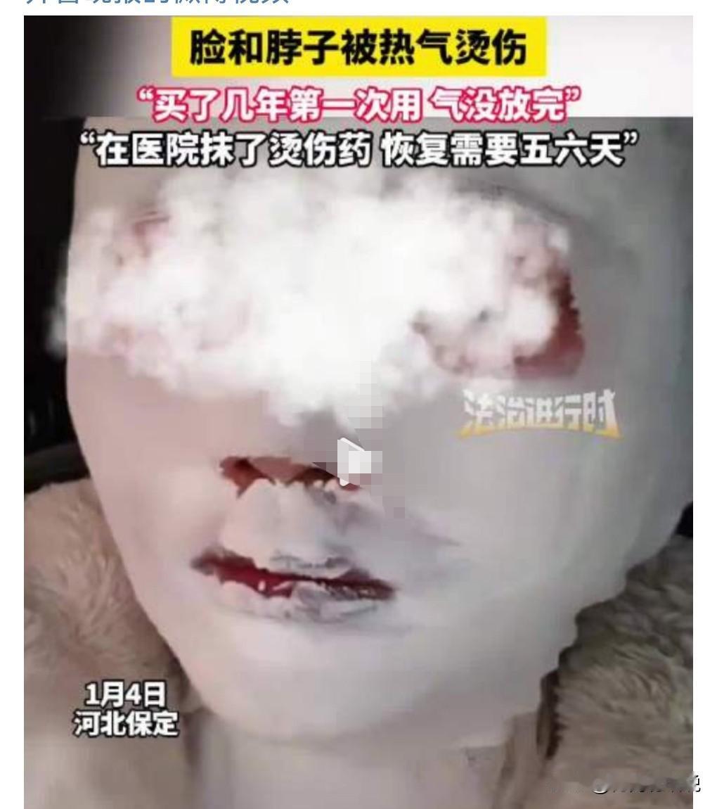 这真的是太危险了。1月4日，河北保定。

女子炖肉时高压锅爆炸被热气烫伤。

女