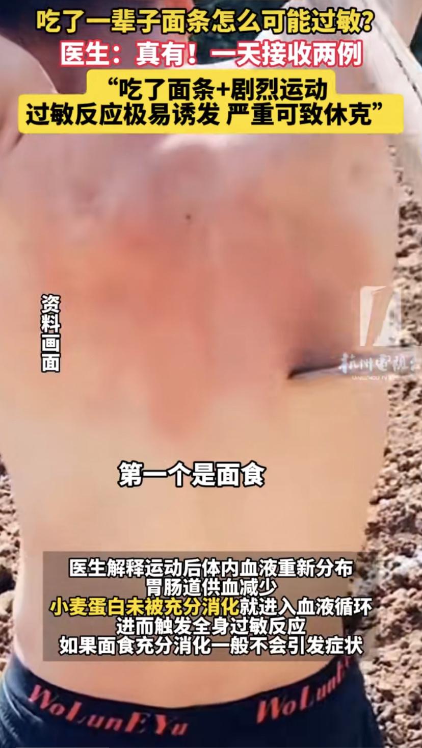 杭州一位30多岁的女士，吃完面条后去打了场羽毛球，结果差点出事!
据浙大一院消息