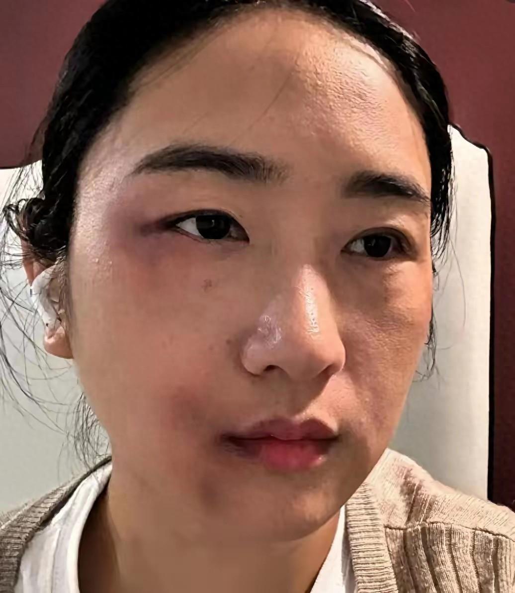 怀孕36周，一脚踢向腰部。她强忍疼痛，默默收集证据直奔派出所，前两次为了家庭隐忍
