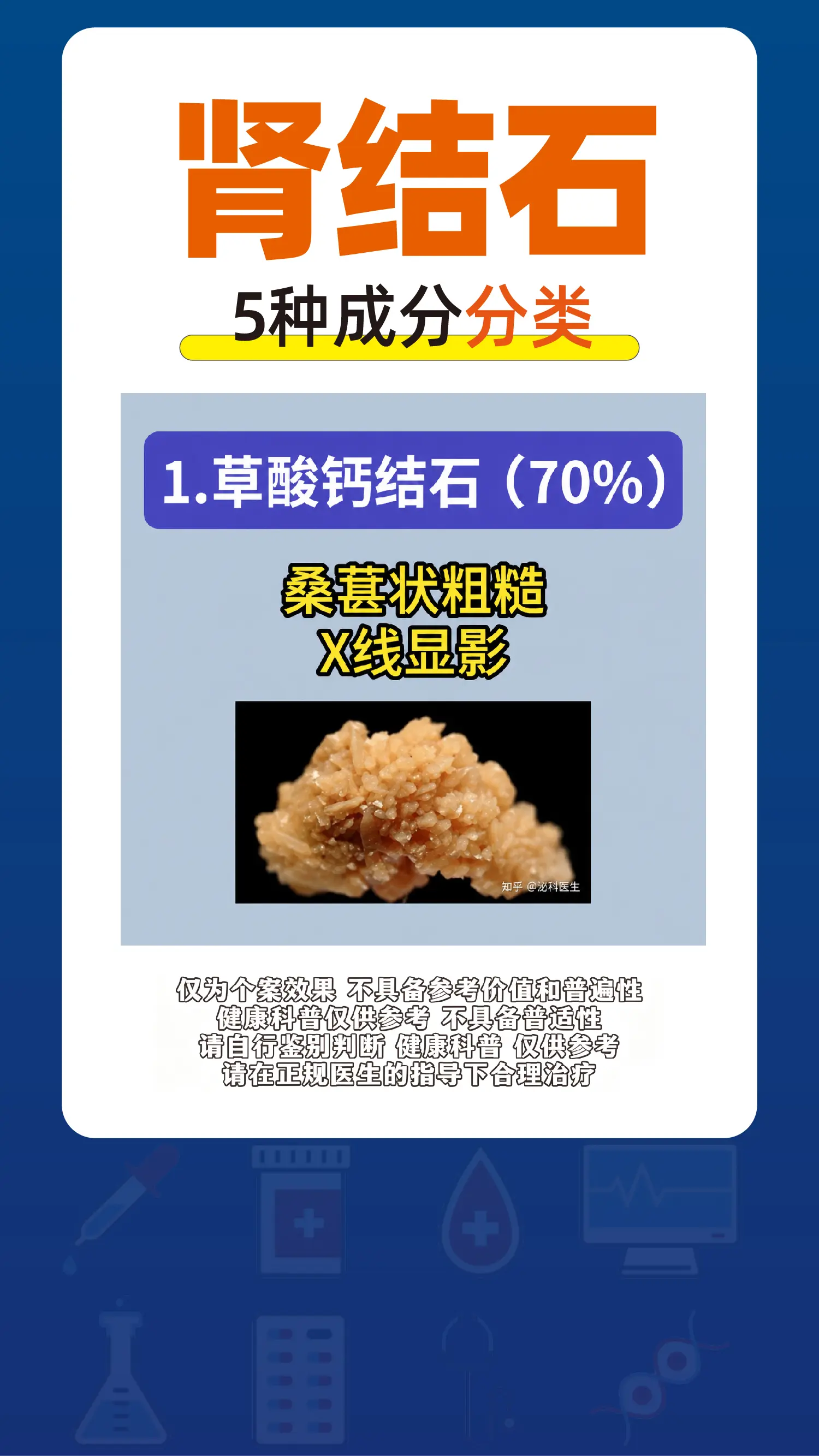 肾结石，5种成分分类，你是哪一种？。