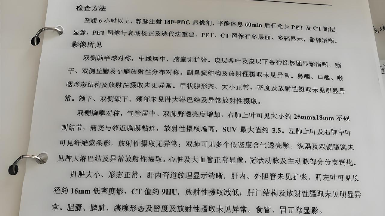 看 PET - CT 报告就像猜谜？这些关键信息一秒看懂

1. FDG代谢增高