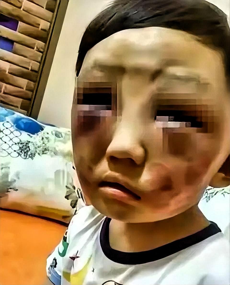 父母离婚后，6岁儿子太想妈妈独自跑来找她。妈妈看到孩子身上有伤心疼追问，孩子怯生