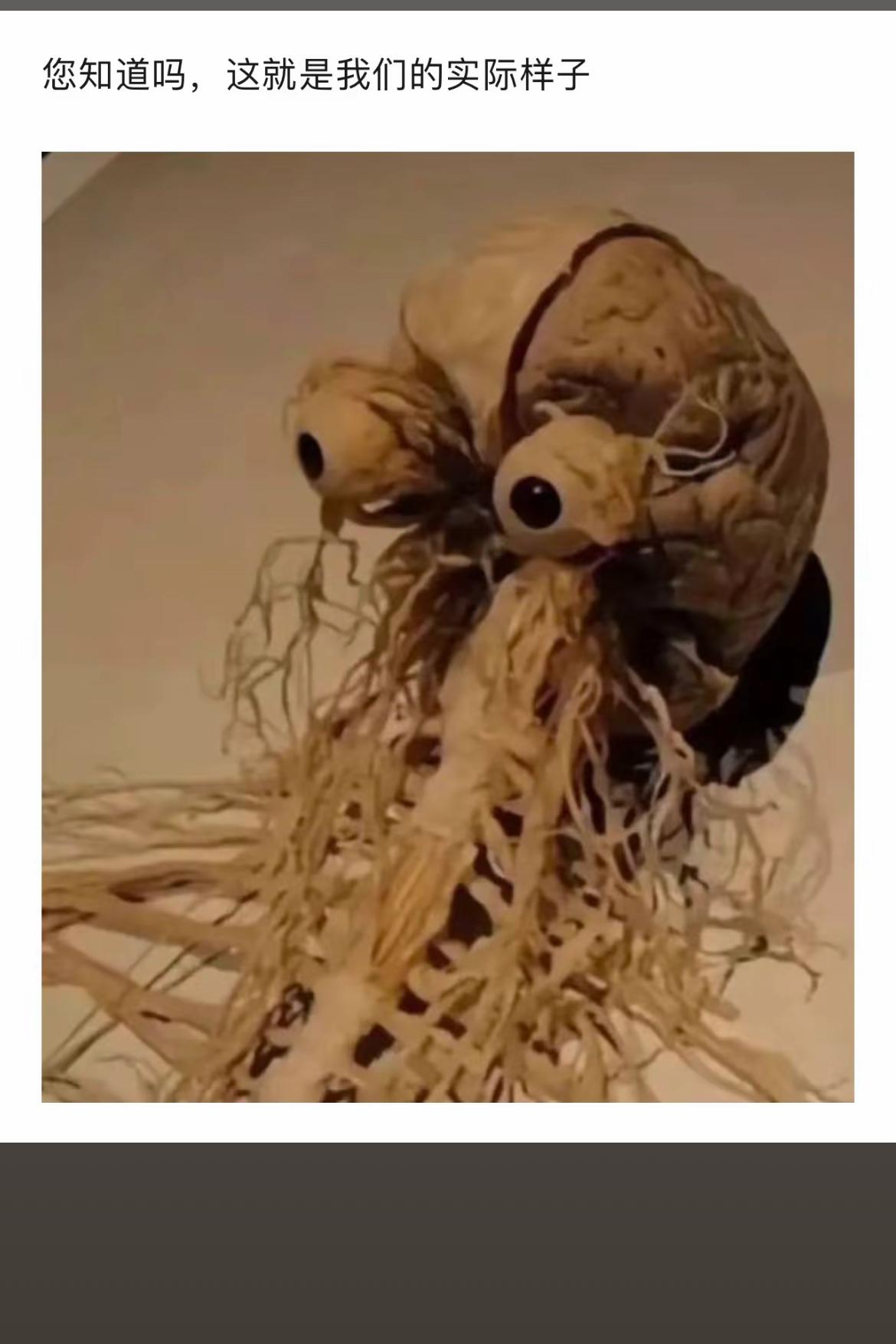 “大脑的奇妙世界，探索神经的奥秘！”🧠🔬🧑‍🔬