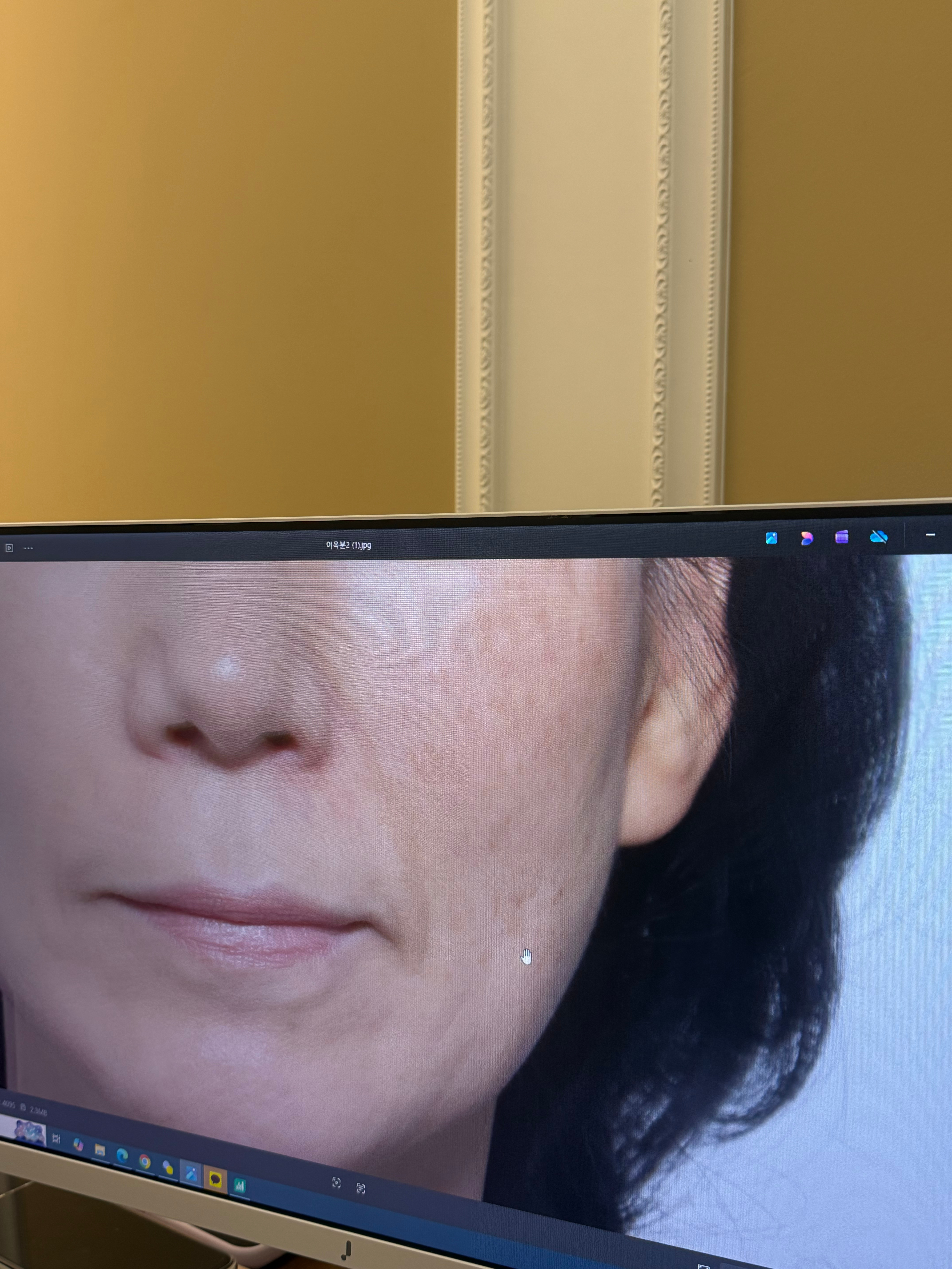 Ultraclear这台机器效果是很心动的，适合老化皮肤，每个人打一次脸直接水光