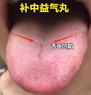 明明都是脾虚，为什么他的方法我用了没有用呢，其实你们脾虚的发展路线不一样，当然需