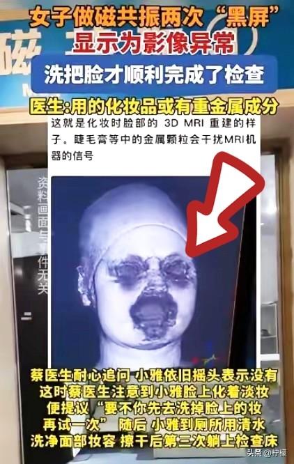 福建一29岁女生头晕，
去医院做头颅磁共振，结果连续两次扫描都因为面部成像异常中