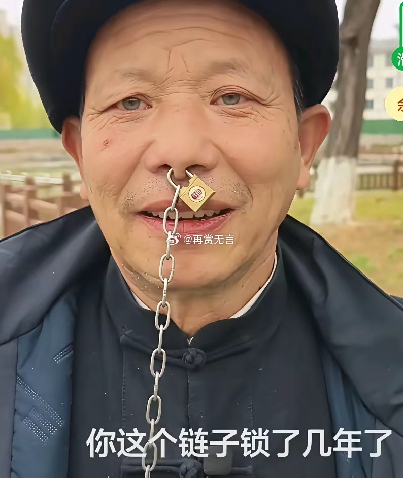 鼻子被老婆上锁25年。当初赌博管不住，喝醉后被老婆用锥子锥透锁上。醒来就这样了，