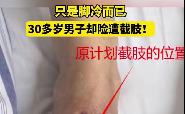 30多岁男子总觉脚冷险遭截肢 别把小不适拖成大麻烦
有没有人跟我一样，天一冷就手