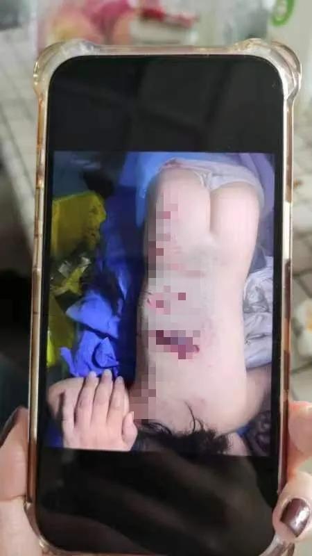 恶犬咬人，而人却不能吃狗肉，爱狗人士这时候集体失声？

四川崇州市的一名两岁女童