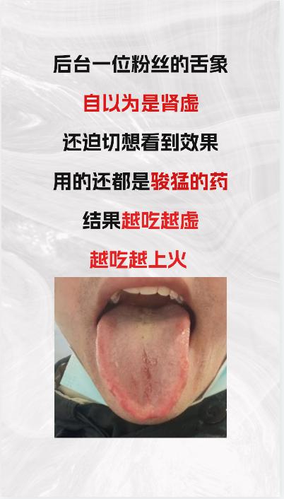 这是后台一位粉丝朋友发来的舌象，本以为是肾虚，但是想赶紧好起来，开始猛补肾，结果