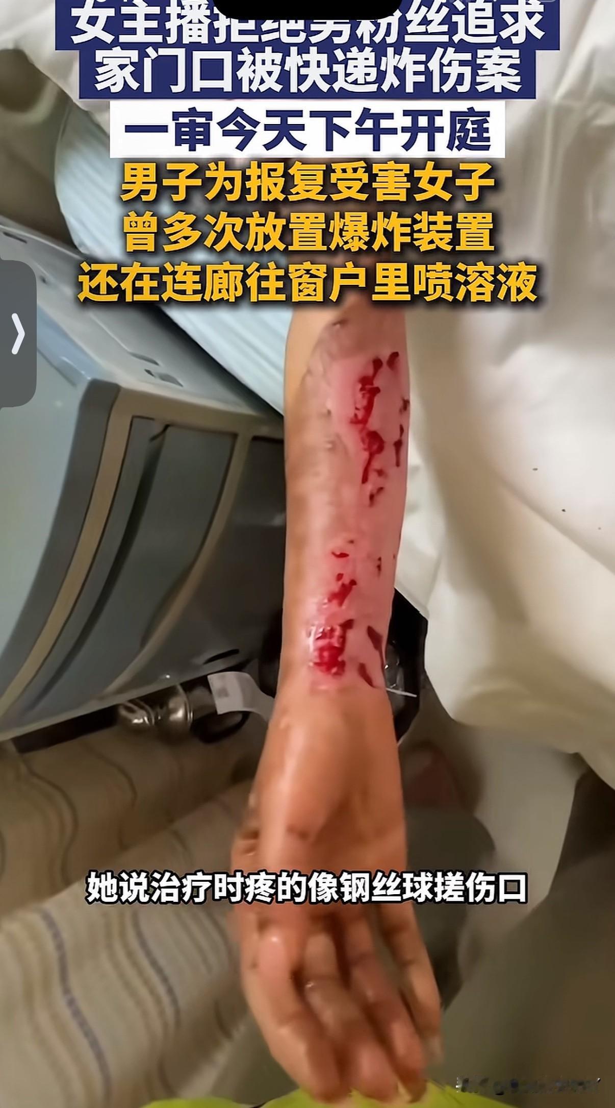 湖南女主播拒绝男粉丝追求被炸一案今天下午一审开庭

湖南一女主播五个月内遭男粉丝