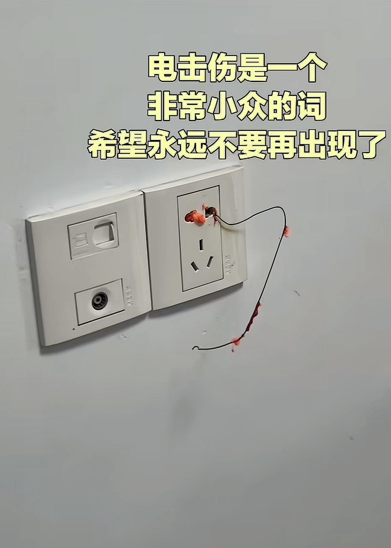 网友分享自己的孩子的被电击伤了，从伤口看还挺严重，不过好在及时送医院了，医生也表