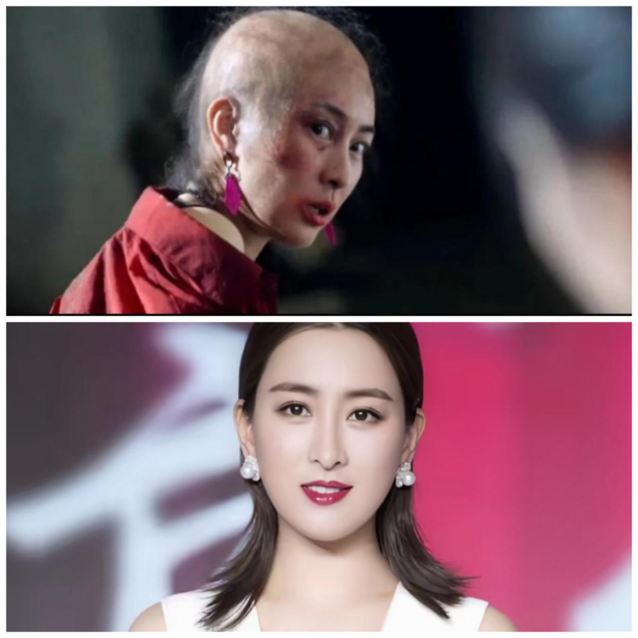 完全认不出！《昨夜将至》里身患乳腺癌晚期的光头角色玲姐，扮演者居然是马苏，第一眼