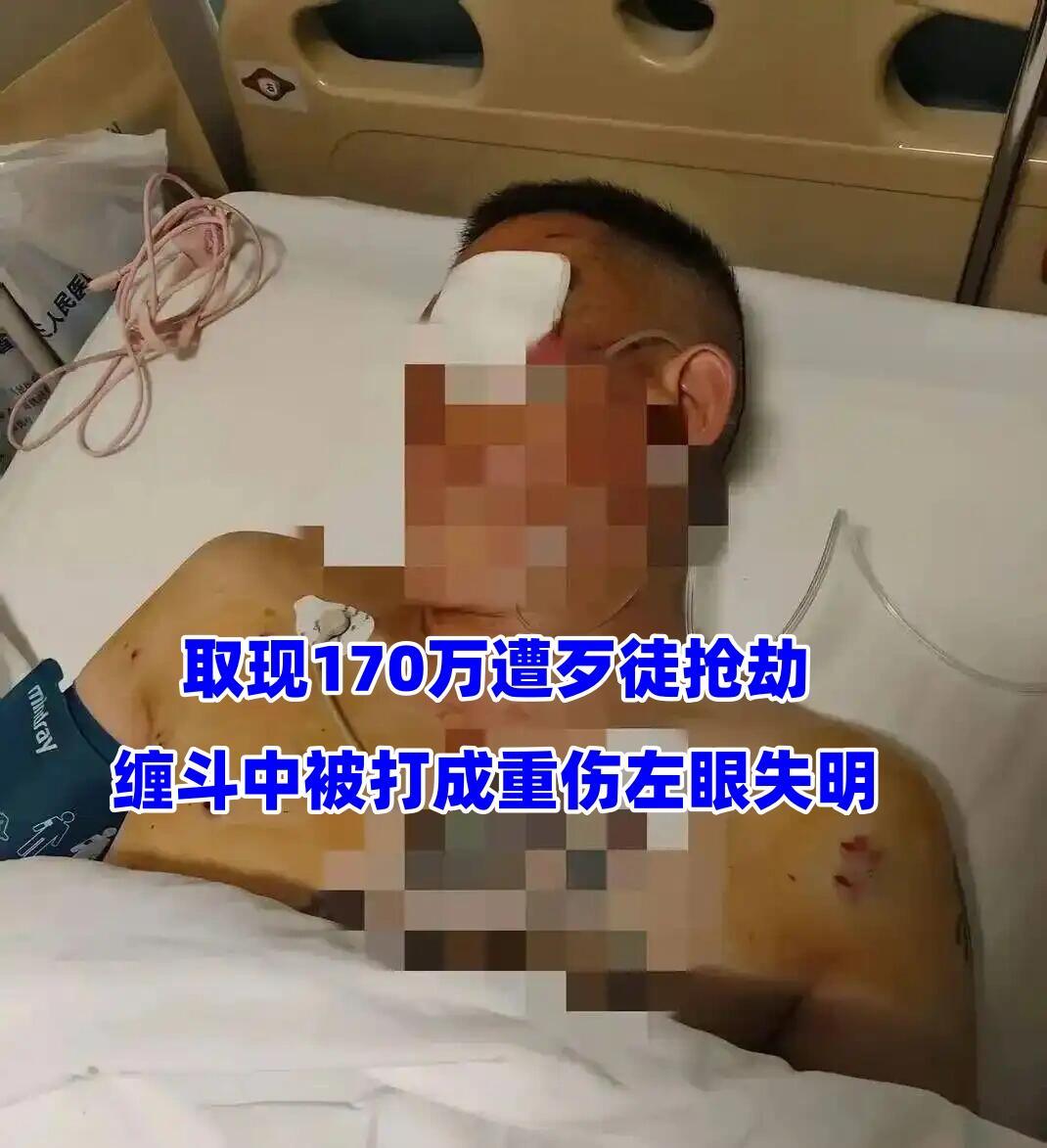 这事儿听着都让人心惊胆战：在银行门口取完170万现金，刚走出去就被人持枪抢劫，搏