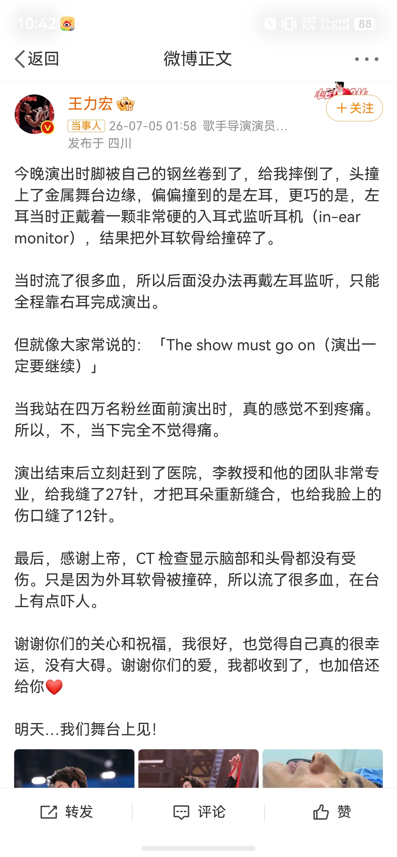 王力宏缝了39针现场视频，你们看了吗？摔的真的非常重，也非常危险。在左耳受伤无法