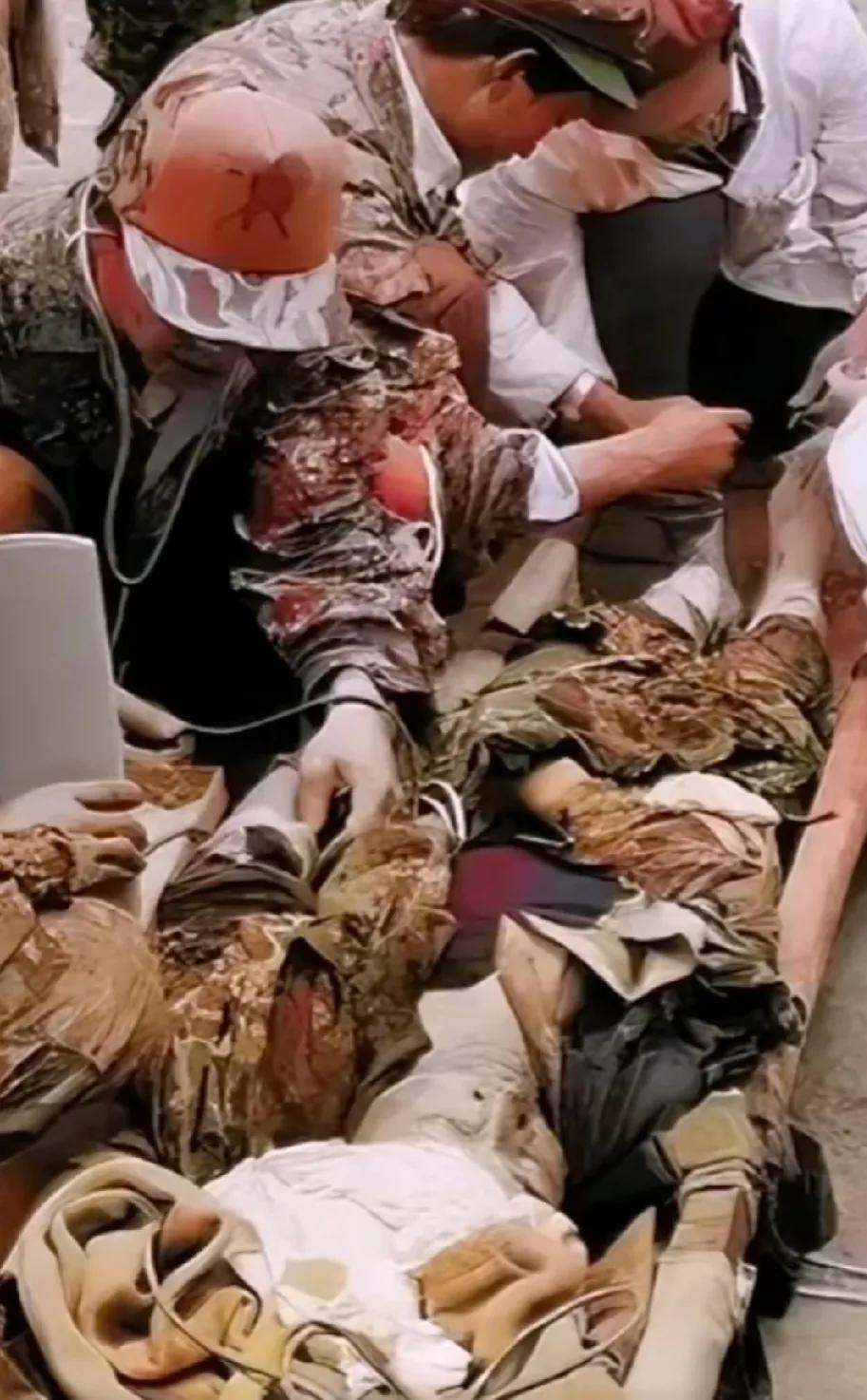 一张令人泪目的照片
第十五侦察三连副连长张凤生被抬下火线，医护人员正在进行抢救！