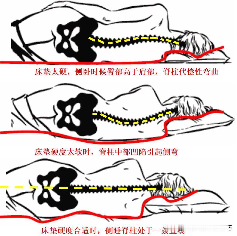 骨科会惩罚每个不正确姿势睡觉的人！这几种睡觉姿势全是错误的，快来看看有没有你！