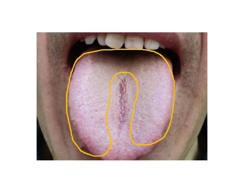 上午不忙，伸舌我看！全程不收费！一个不漏，1分钟告知病因和调理方向！男人要注意这