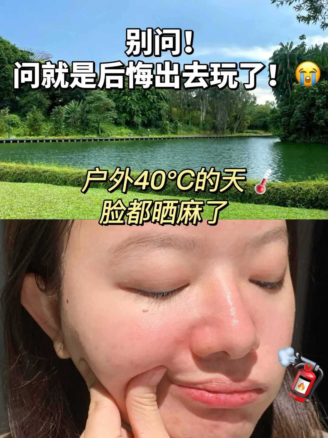 旅行？暴晒！赶紧用这个水灵灵的急救一下！
