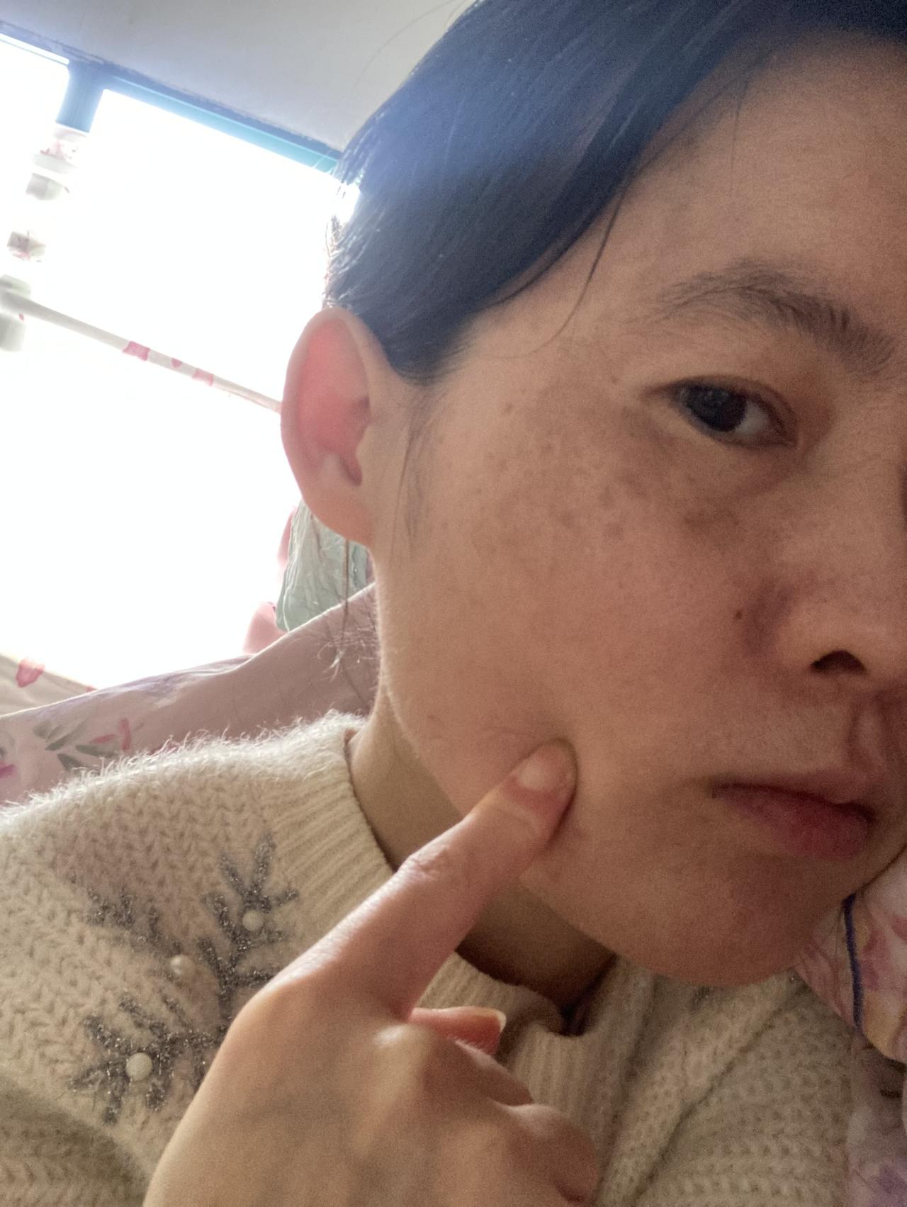 镜头会把人拍胖，看这短短的手指🫢 今天吃了个午饭，好几个月里第一次吃午饭，肚子