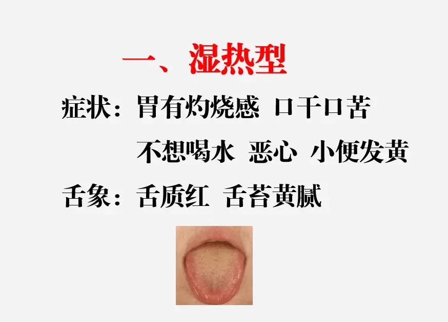 胃痛胃酸胃炎是很多人都会遇到的问题，今天我就来给大家分享四个中成药，帮你横扫胃痛