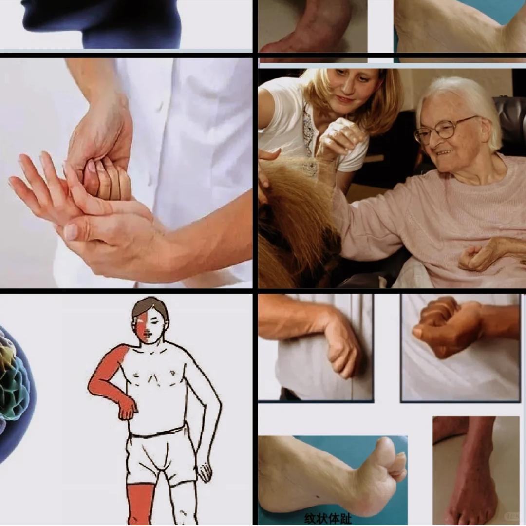 开始供暖了，这是偏瘫/脊髓损伤患者的新挑战！

近日北方陆续开始供暖，室内温暖如